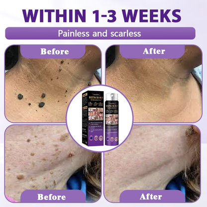 Made and Shipped from Australia ✨Evolvion® Biotin 10-in-1 Skin Restoration Spray 🍀-up