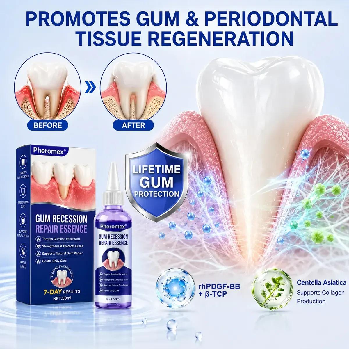 Pheromex® 🦷GumRevive Periodontal Care Gel🛑🛑