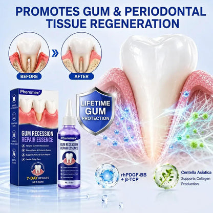 Pheromex® 🦷GumRevive Periodontal Care Gel🛑🛑