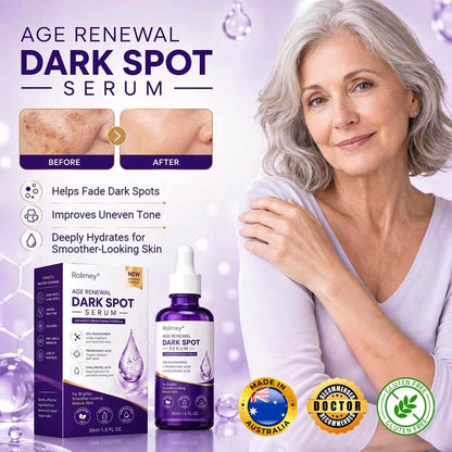 Rolimey® Age Renewal Dark Spot Serum — Infused with 10% Niacinamide, Tranexamic Acid & Hyaluronic Acid for Brighter, Smoother-Looking Mature Skin 🍀