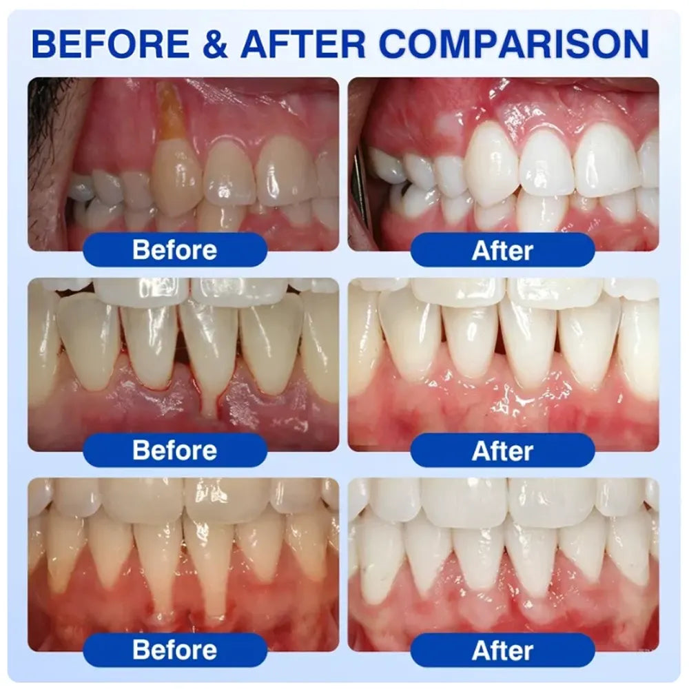 Pheromex® 🦷GumRevive Periodontal Care Gel🛑🛑