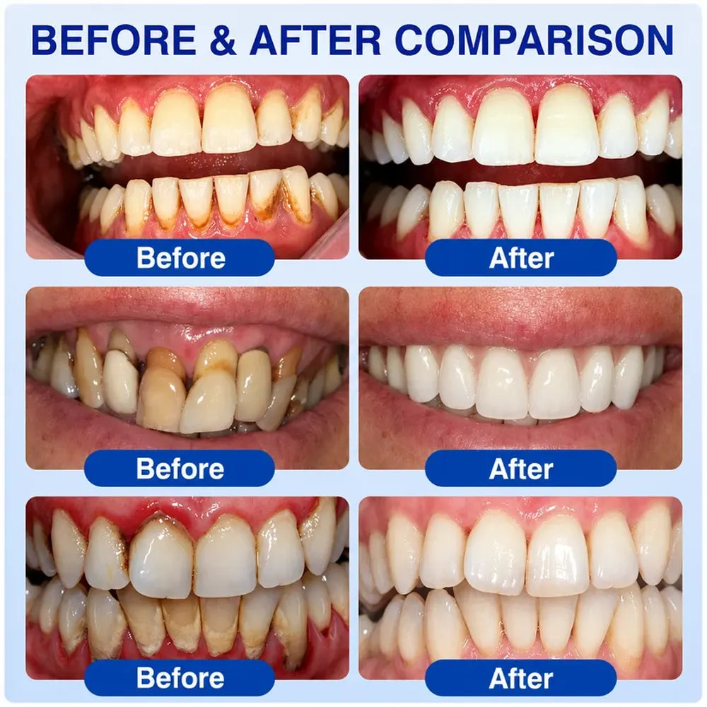 Pheromex® 🦷GumRevive Periodontal Care Gel🛑🛑