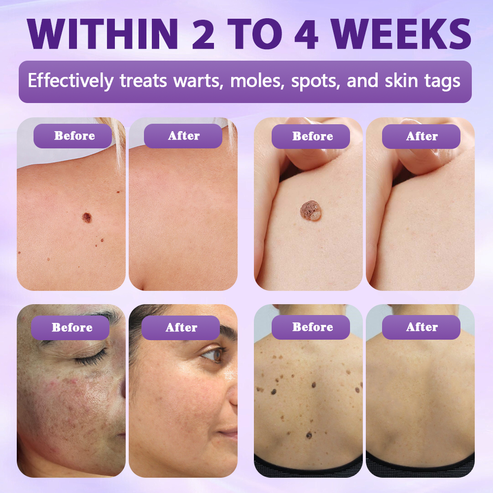 Made and Shipped from Australia ✨Evolvion® Biotin 10-in-1 Skin Restoration Spray 🍀-up