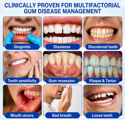 Pheromex® 🦷GumRevive Periodontal Care Gel🛑🛑