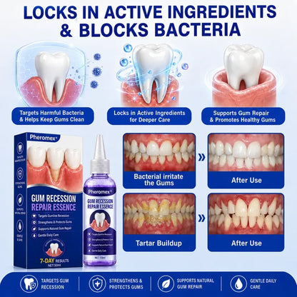 Pheromex® 🦷GumRevive Periodontal Care Gel🛑🛑