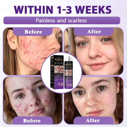 Made and Shipped from Australia ✨Evolvion® Biotin 10-in-1 Skin Restoration Spray 🍀-up